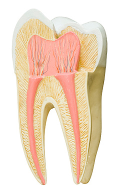 Model of tooth showing root canal